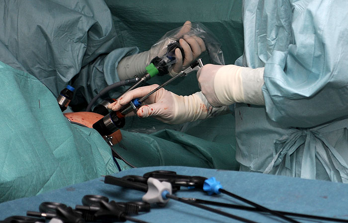 Minimalinvasive Operationen – Schlüssellochchirurgie